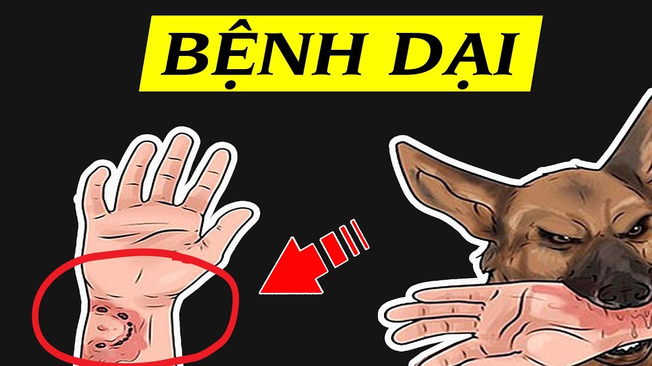 benh-dai