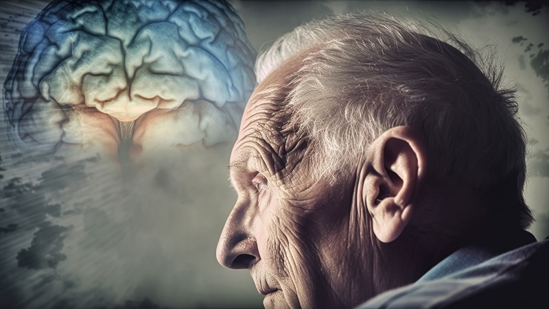 Alzheimer ảnh hưởng đến hàng triệu người trên toàn thế giới và hiện chưa có phương pháp điều trị hiệu quả