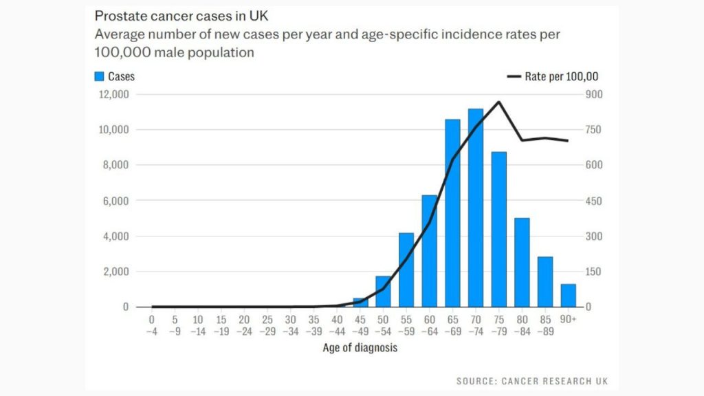 Thống kê về số ca mắc ung thư tuyến tiền liệt ở Anh