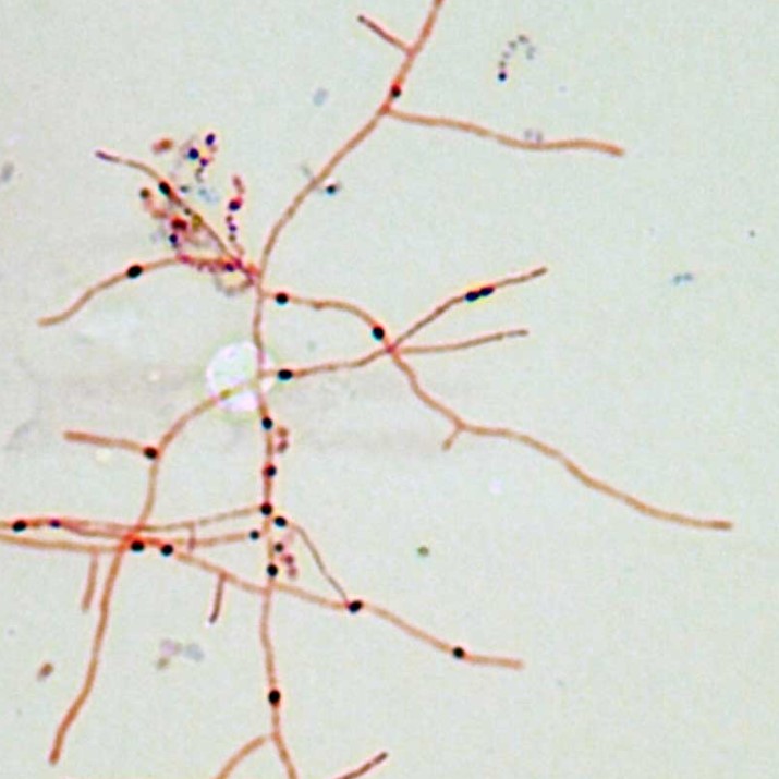 Vi khuẩn như Nocardia (trong hình trên) có thể gây viêm phổi hoặc viêm não