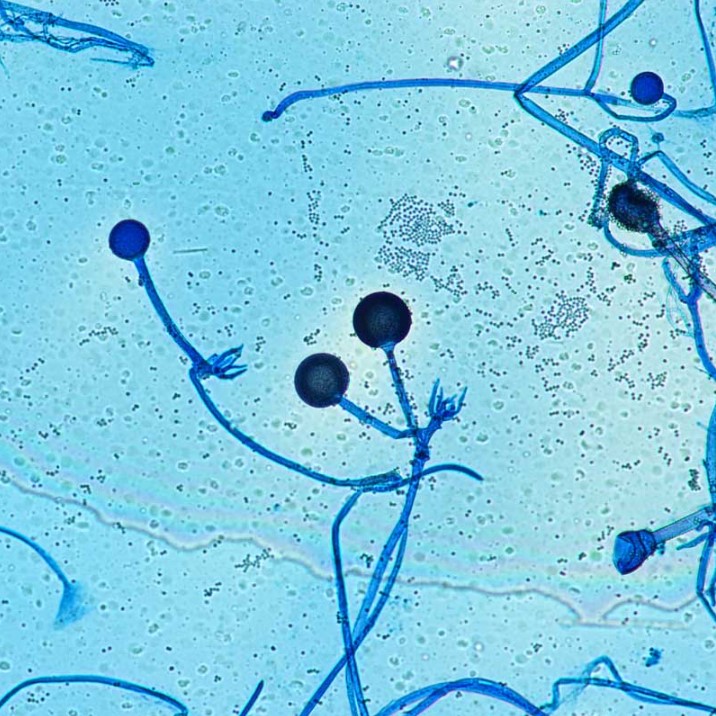 Nấm như Rhizopus (trong hình trên) có thể nhiễm vào dịch não tủy và dịch hô hấp