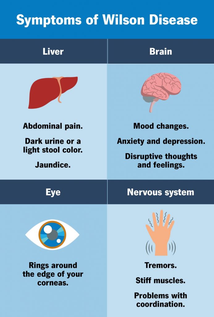 Biểu hiện của bệnh Wilson