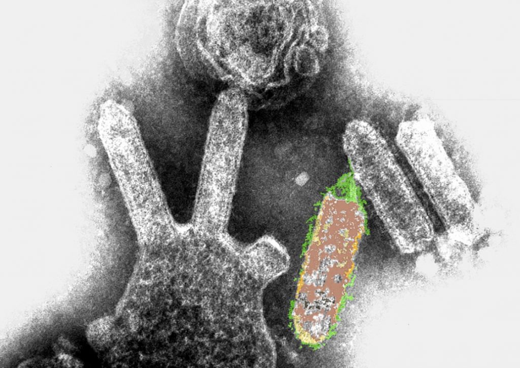 Hình ảnh hiển vi điện tử truyền qua có màu của lyssavirus dơi Úc. Những cấu trúc hình viên đạn là các hạt virus, một số đang nảy chồi ra khỏi tế bào