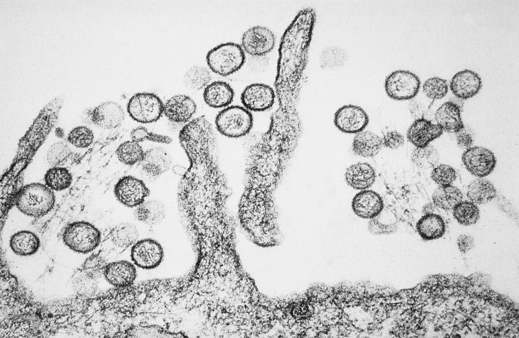 Truyền vi điện tử của Sin Nombre orthohantavirus