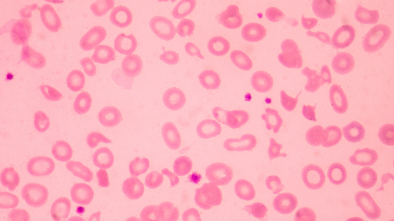 gen-thalassemia